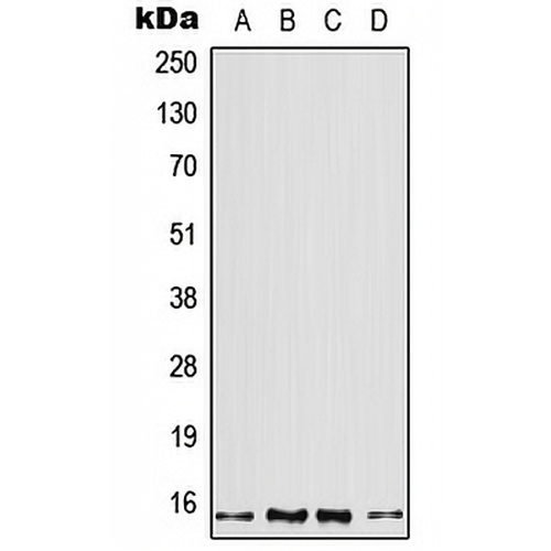 Profilin 2 Rabbit Polyclonal Antibody