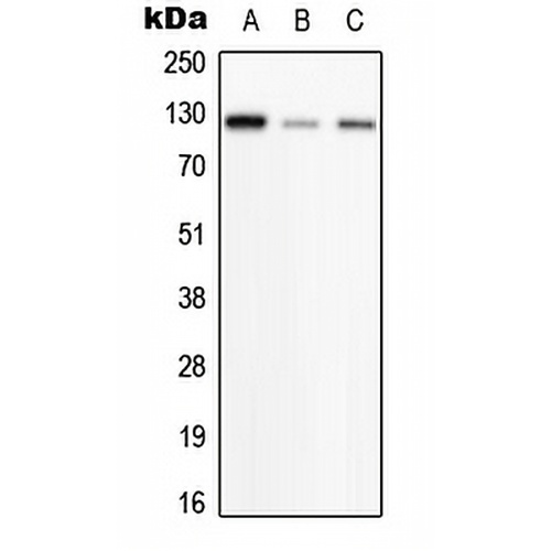 PHKB Rabbit Polyclonal Antibody