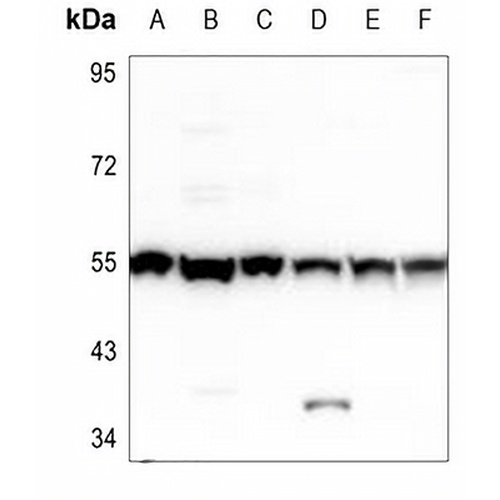 PHKG1 Rabbit Polyclonal Antibody