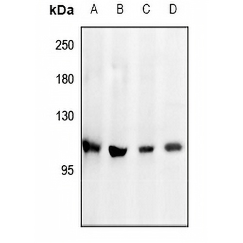 PI3K p110 delta Rabbit Polyclonal Antibody