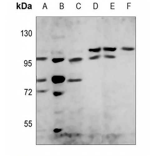 PI3K p85 beta Rabbit Polyclonal Antibody