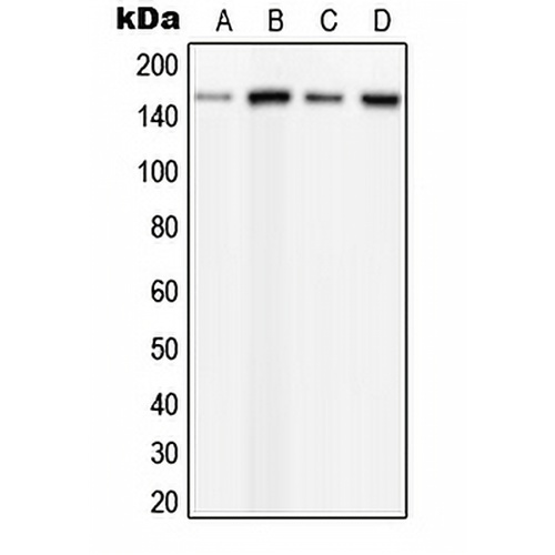 PLC beta 3 (Phospho-S537) Rabbit Polyclonal Antibody