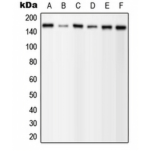 PLC gamma 1 (Phospho-Y1253) Rabbit Polyclonal Antibody