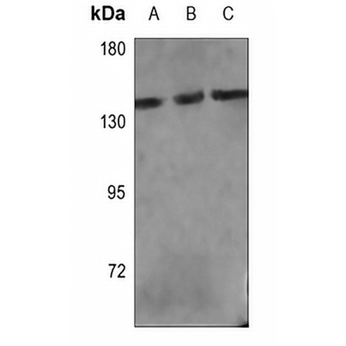 PLC gamma 1 Rabbit Polyclonal Antibody