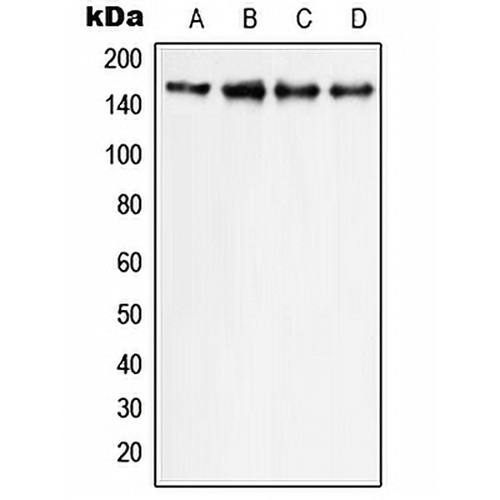 PLC gamma 1 Rabbit Polyclonal Antibody