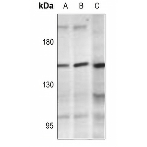 PLC gamma 2 (Phospho-Y1217) Rabbit Polyclonal Antibody