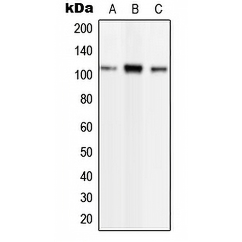 Phospholipase D2 (Phospho-Y169) Rabbit Polyclonal Antibody