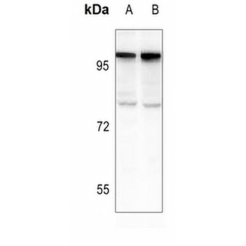 PML Rabbit Polyclonal Antibody