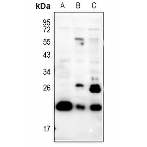 PRRX1 Rabbit Polyclonal Antibody