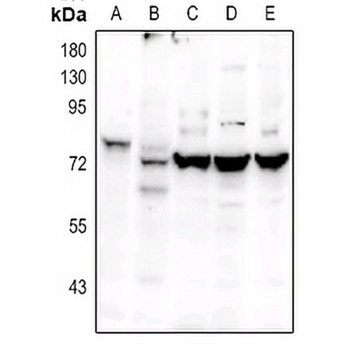 OCT2 Rabbit Polyclonal Antibody