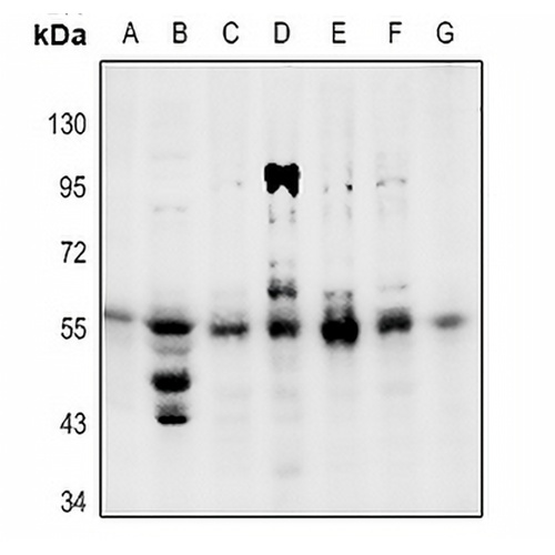 PPAR gamma (Phospho-S112) Rabbit Polyclonal Antibody