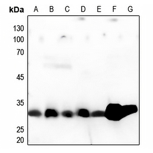 Cathepsin A 32k Rabbit Polyclonal Antibody