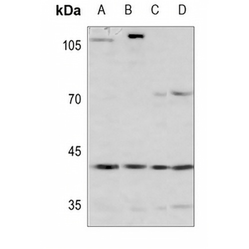 ARD1 Rabbit Polyclonal Antibody