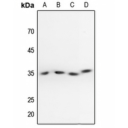 PPP2CA (Phospho-Y307) Rabbit Polyclonal Antibody