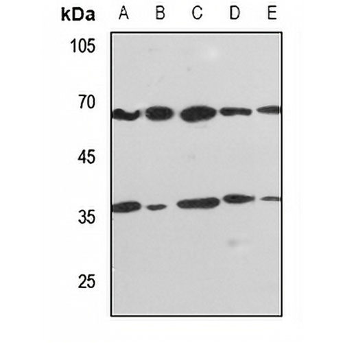PPP2R1B Rabbit Polyclonal Antibody