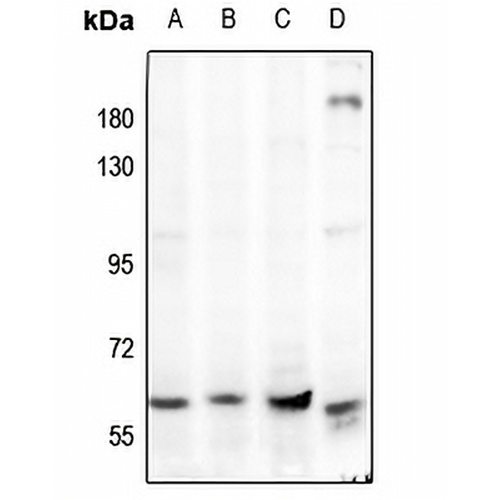 AMPK alpha 1/2 Rabbit Polyclonal Antibody