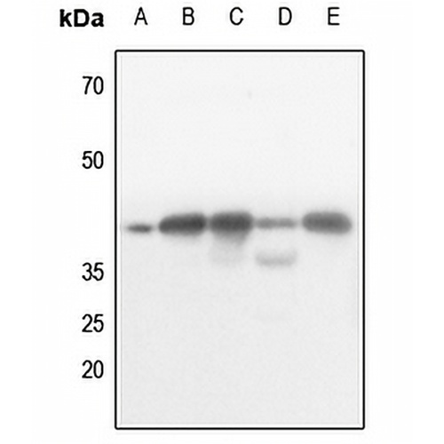 AMPK beta 1 (Phospho-S182) Rabbit Polyclonal Antibody