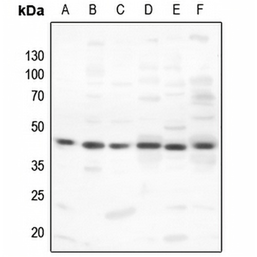 PKA C alpha/beta Rabbit Polyclonal Antibody