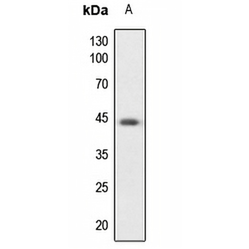 PKA C alpha/beta/gamma Rabbit Polyclonal Antibody