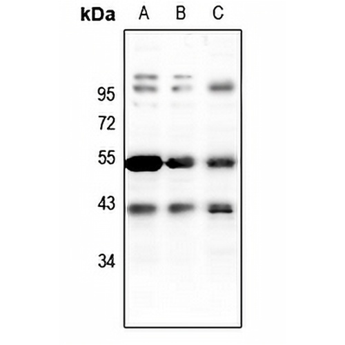 PKA C beta Rabbit Polyclonal Antibody