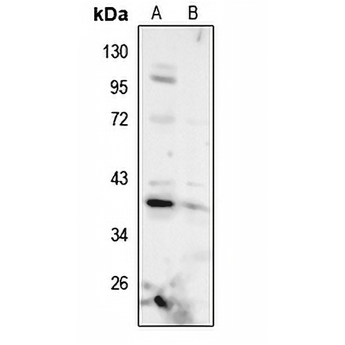 AMPK gamma 1 Rabbit Polyclonal Antibody