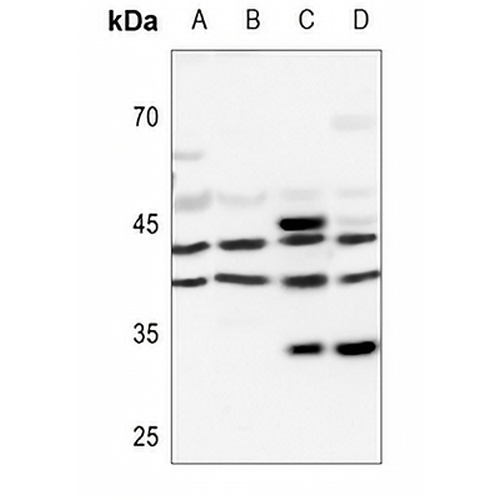 PRKAR1A Rabbit Polyclonal Antibody