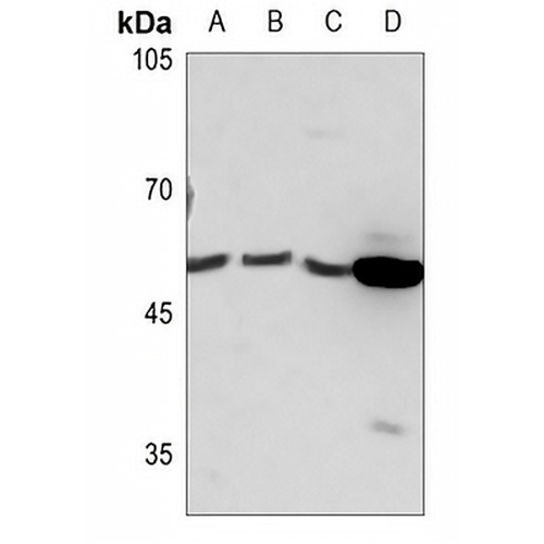 PRKAR1B Rabbit Polyclonal Antibody