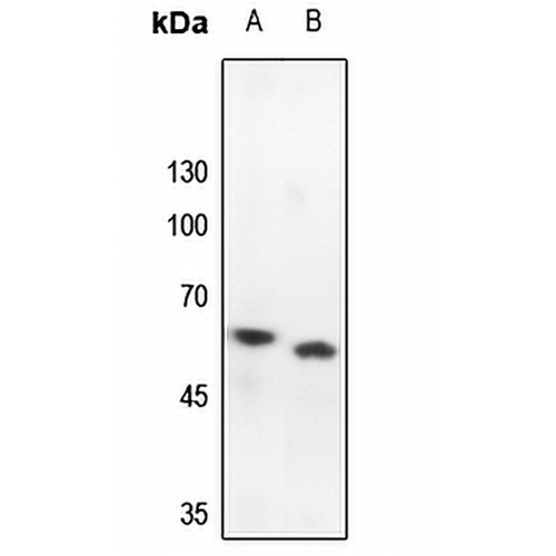 PRKAR2B Rabbit Polyclonal Antibody