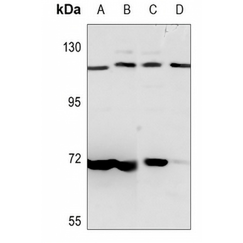 PKN1 Rabbit Polyclonal Antibody