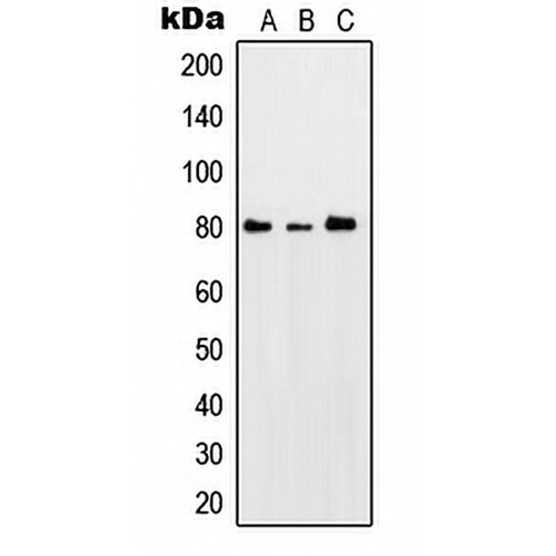 PKC theta (Phospho-S676) Rabbit Polyclonal Antibody