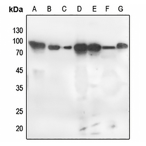 PKC zeta (Phospho-T560) Rabbit Polyclonal Antibody