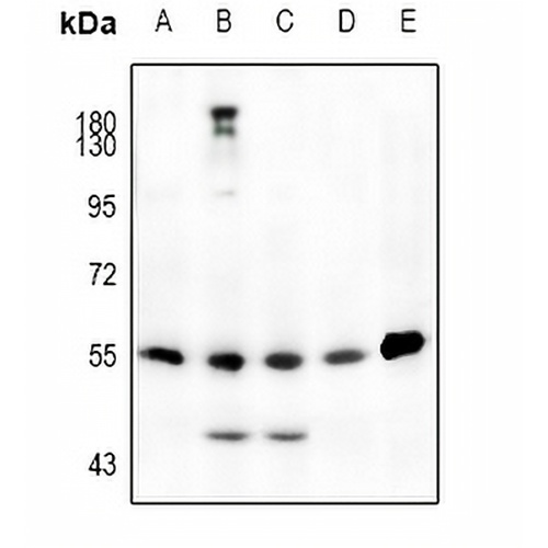 JNK1/2/3 (Phospho-T183) Rabbit Polyclonal Antibody
