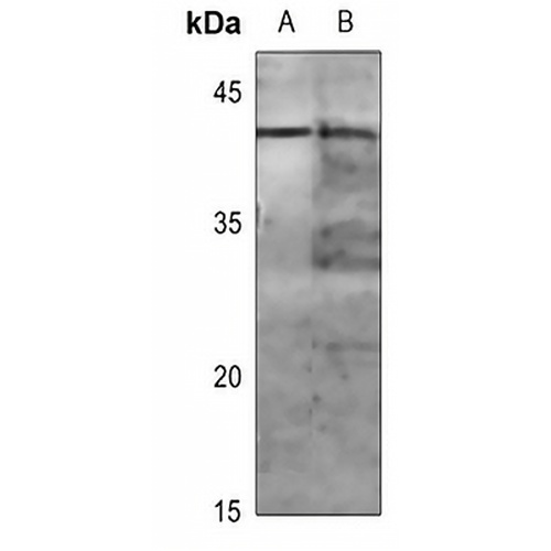 MKK1 (Phospho-T286) Rabbit Polyclonal Antibody