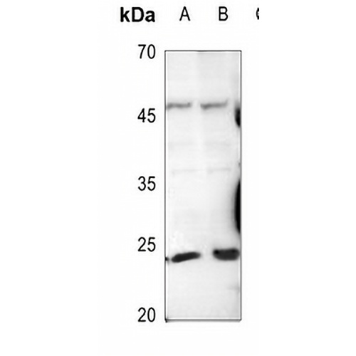 Trypsin 1 Rabbit Polyclonal Antibody