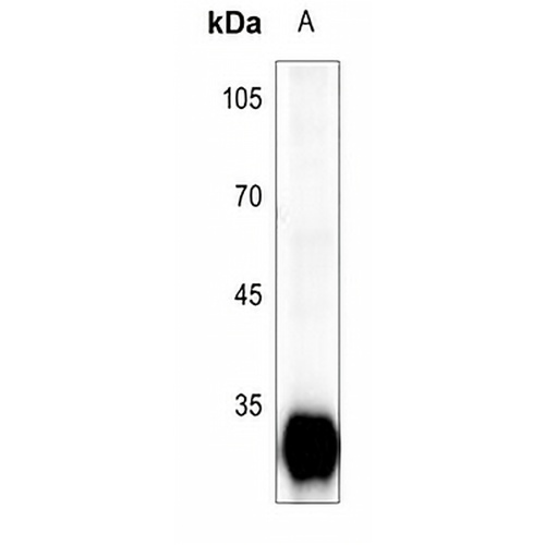 Trypsin 3 Rabbit Polyclonal Antibody