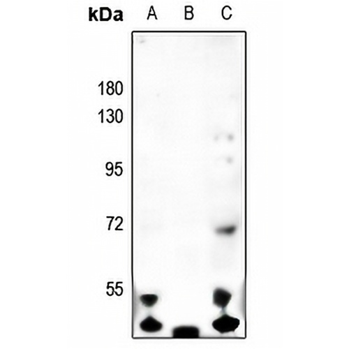 MASP1 HC Rabbit Polyclonal Antibody