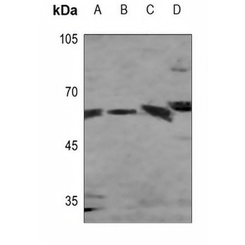 Presenilin 1 Rabbit Polyclonal Antibody