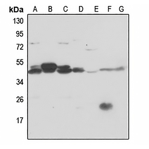 PSMC6 Rabbit Polyclonal Antibody
