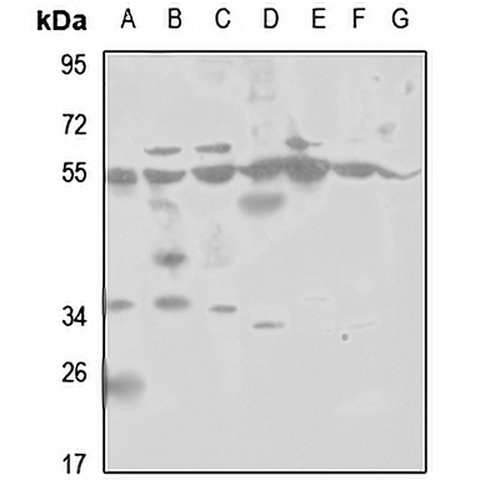 PSMD12 Rabbit Polyclonal Antibody