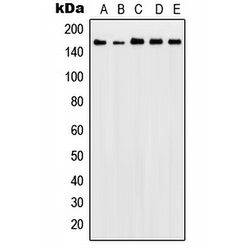 Patched Rabbit Polyclonal Antibody