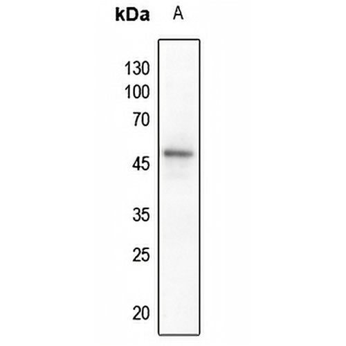 PTEN Rabbit Polyclonal Antibody