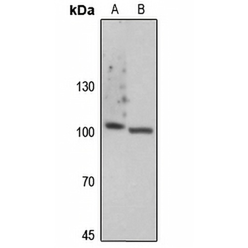 Focal Adhesion Kinase (Phospho-Y861) Rabbit Polyclonal Antibody