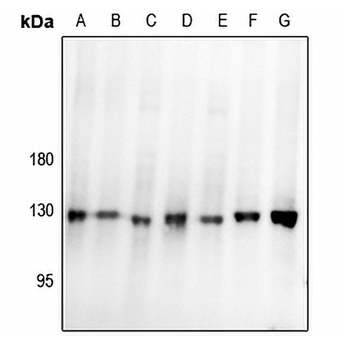 Focal Adhesion Kinase Rabbit Polyclonal Antibody