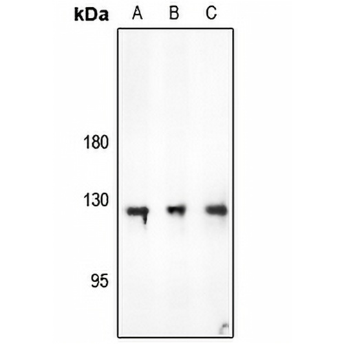 Focal Adhesion Kinase Rabbit Polyclonal Antibody