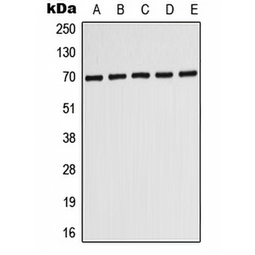 ABCD3 Rabbit Polyclonal Antibody