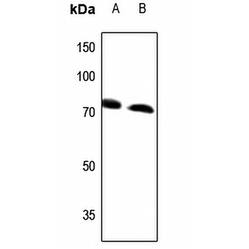 ABCD4 Rabbit Polyclonal Antibody