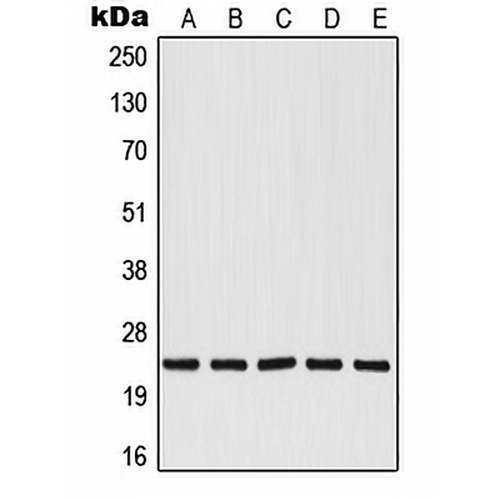 RALB Rabbit Polyclonal Antibody