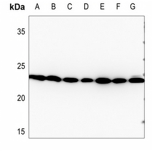 RAN Rabbit Polyclonal Antibody