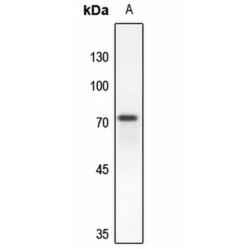 RAP1GAP Rabbit Polyclonal Antibody