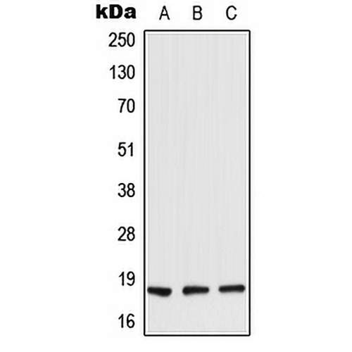 TIG2 Rabbit Polyclonal Antibody